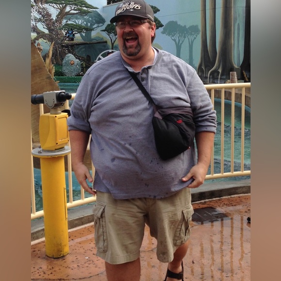 Raising money to help pay for my skin removal surgery after dropping 200 pounds! - Picture 3 of 5